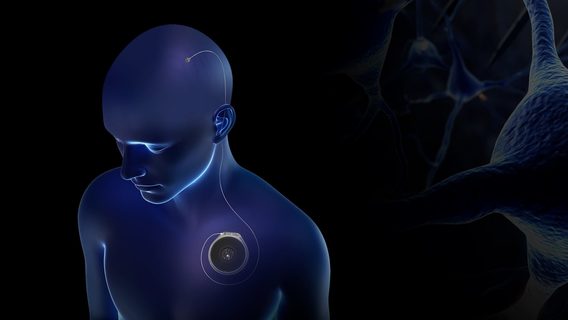 Стартап Paradromics вперше встановив пацієнту свій мозковий імплантат. Його видалили вже через 10 хвилин