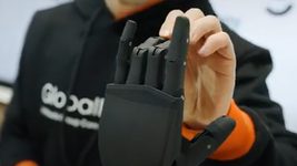 Защитникам, потерявшим конечности на войне, провели 3D-сканирование. Это первый этап перед установкой бионических протезов