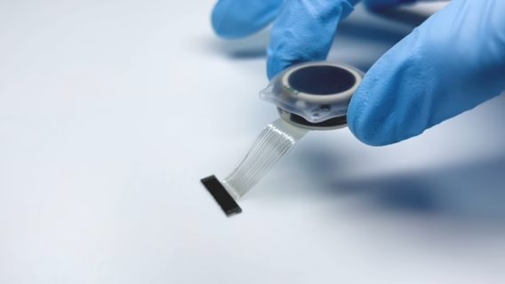 Neuralink шукає пацієнтів із паралічем по всьому світу для участі в дослідженнях мозкового чипа