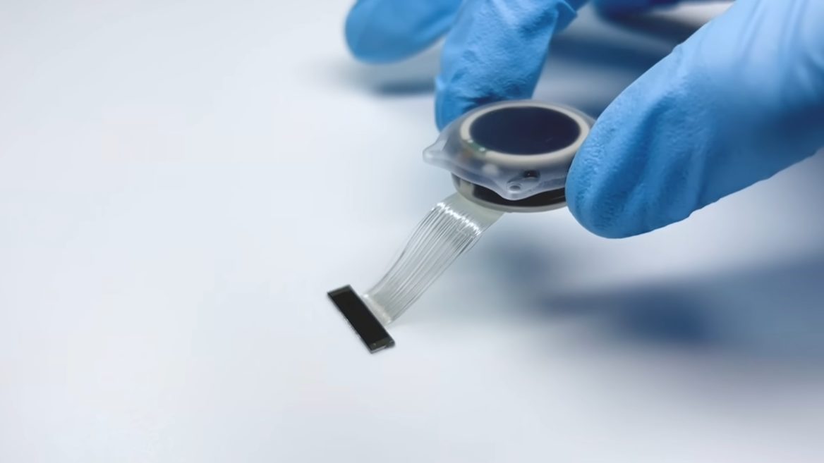 Neuralink шукає пацієнтів із паралічем по всьому світу для участі в дослідженнях мозкового чипа
