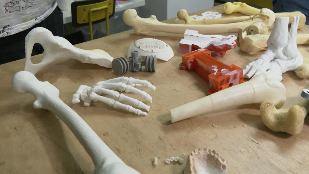 Ивано-Франковский медик спроектировал протез руки для военного с помощью 3D-печати