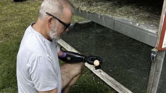 Польская компания разработала биопротез, которым можно взять сырое яйцо и не раздавить его. Как она собирается помочь Украине