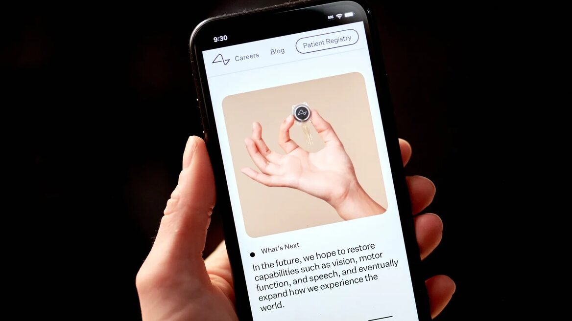 Neuralink Ілона Маска планує перетворювати думки на текст за допомогою своїх мозкових імплантів 