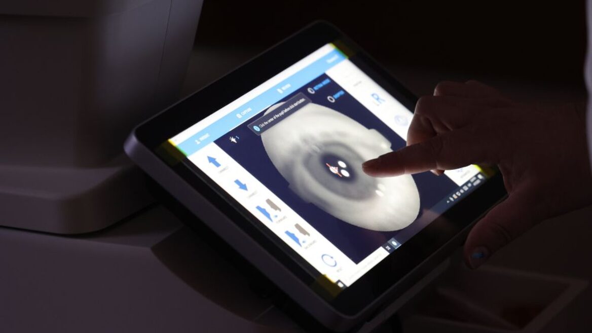 Ukrainian startup CheckEye has raised $700,000 in investment in three years