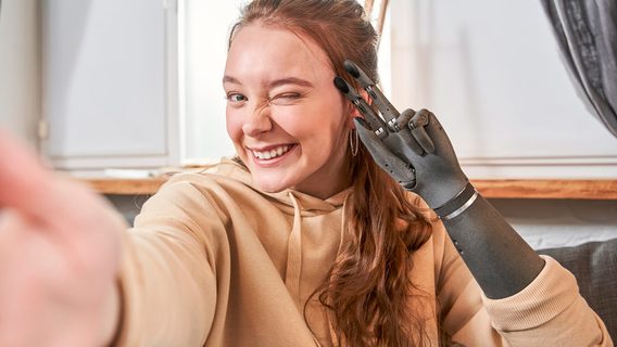 Украинский стартап готовится к продаже роботизированных конечностей в протезных клиниках США. Что о нем известно