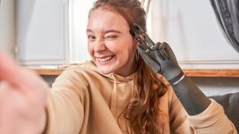 Український стартап готується до продажу роботизованих кінцівок у протезних клініках США. Що про нього відомо