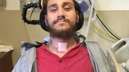 Перша людина з мозковим чипом Neuralink від Ілона Маска визнала, що його можна зламати