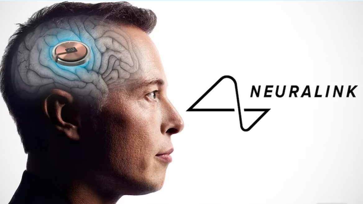 Тестирование чипов Neuralink на людях скоро начнется. Разрешение получено