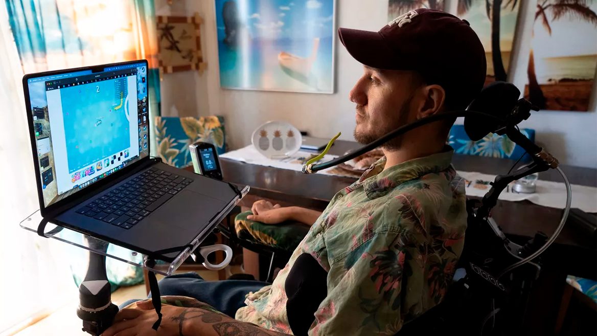 «Було боляче емоційно». Перший пацієнт із чипом Neuralink розповів про свої враження від проблеми що виникла коли імплант змістився