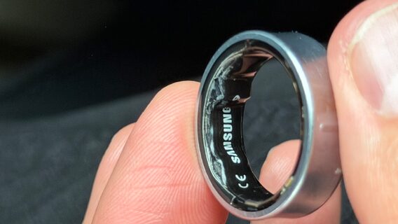 The battery of the Samsung Galaxy Ring smart ring swelled right on the user's finger - he had to go to the hospital