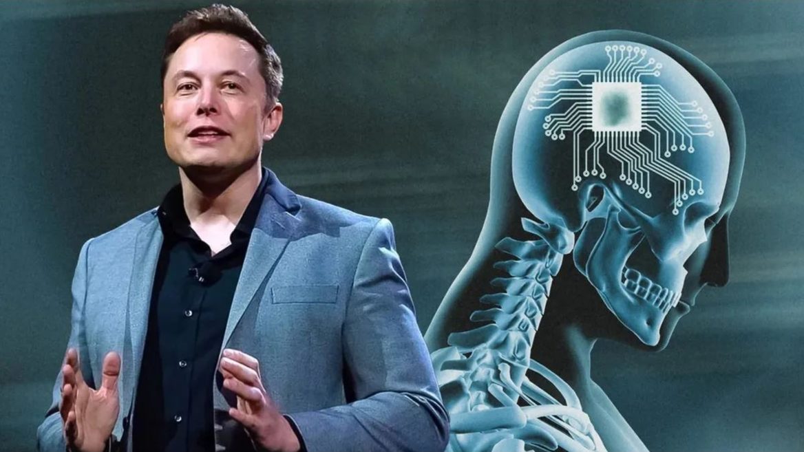Neuralink компанія Маска з розробки мозкових чипів залучила $650 млн фінансування: на що підуть кошти 