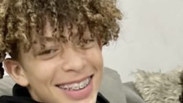Горячий TikTok-challenge. Американский подросток, следуя трендовому вызову в TikTok, получил ожоги 75% тела