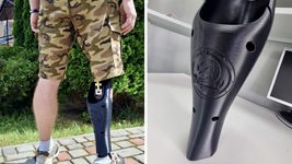 Подружжя медиків із Тернополя започаткували проєкт 3D-друку безплатних персоналізованих накладок на протези для військових