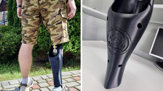Подружжя медиків із Тернополя започаткували проєкт 3D-друку безплатних персоналізованих накладок на протези для військових