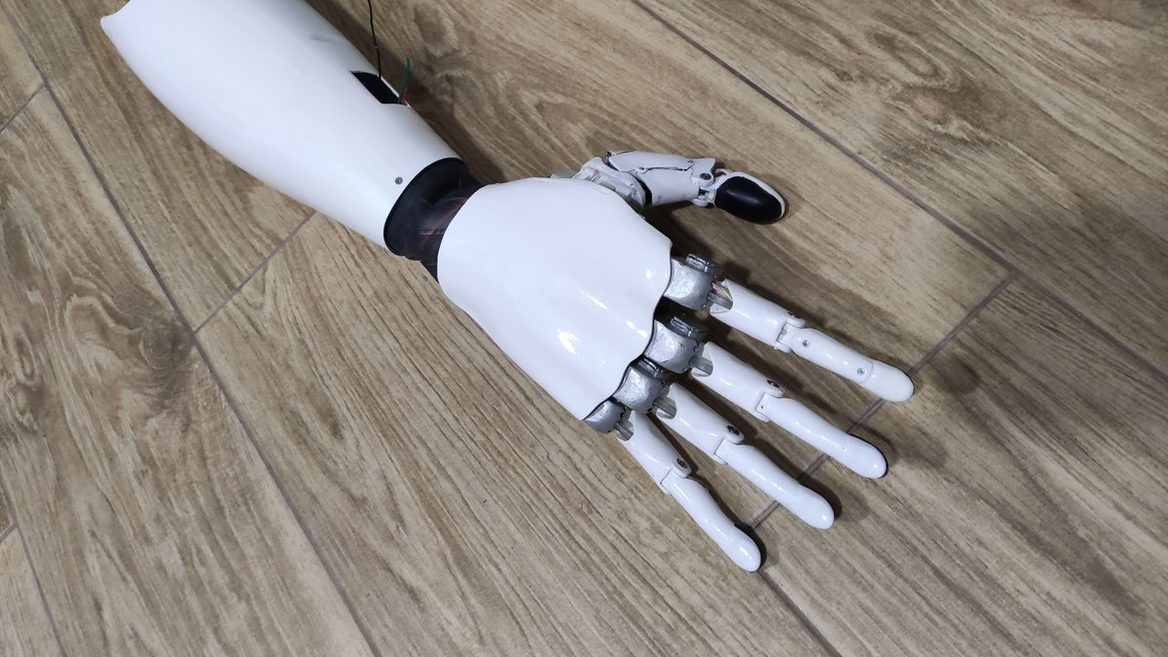 «Если пациент отбил палец, его можно самому заменить». В украинской Versi Bionics разработавшей биоруку рассказали о технических характеристиках устройства