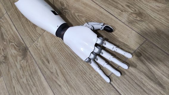 «Если пациент отбил палец, его можно самому заменить». В украинской Versi Bionics, разработавшей биоруку, рассказали о технических характеристиках устройства