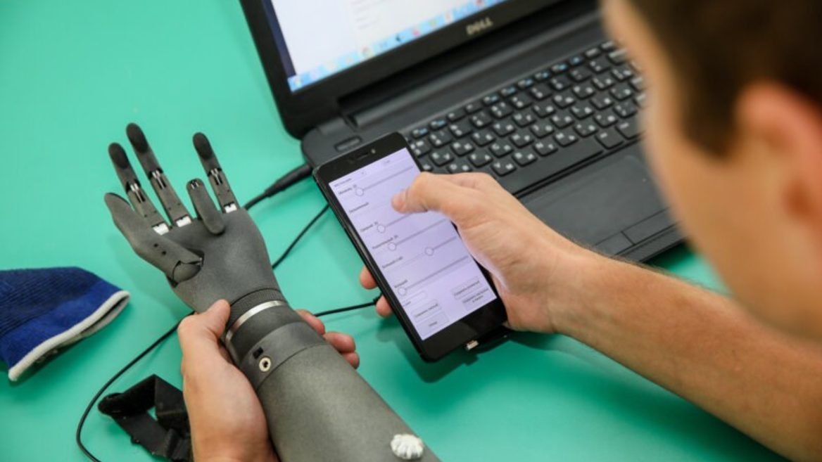 Cтартап Esper Bionics збирає дані українців з ампутаціями щоб запропонувати їм роборуки після перемоги