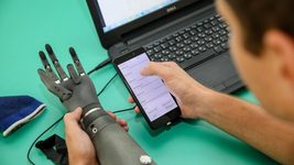 Cтартап Esper Bionics собирает данные украинцев с ампутациями, чтобы предложить им роборуки после победы